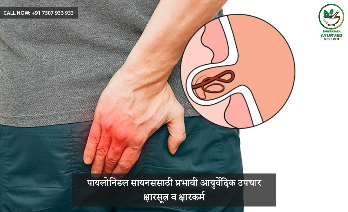 पायलोनिडल सायनससाठी प्रभावी आयुर्वेदिक उपचार | क्षारसूत्र व क्षारकर्म