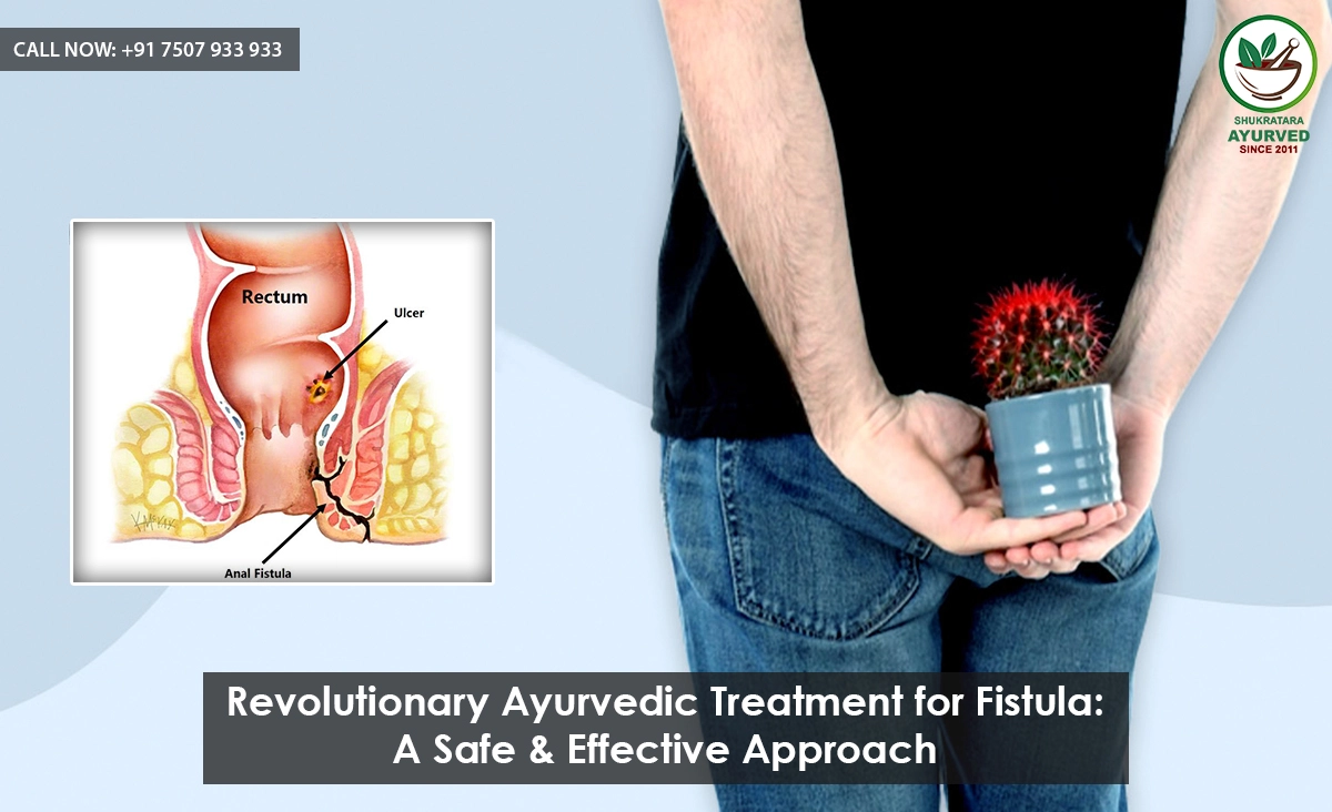 Revolutionary Ayurvedic Treatment for Fistula: A Safe & Effective Approach