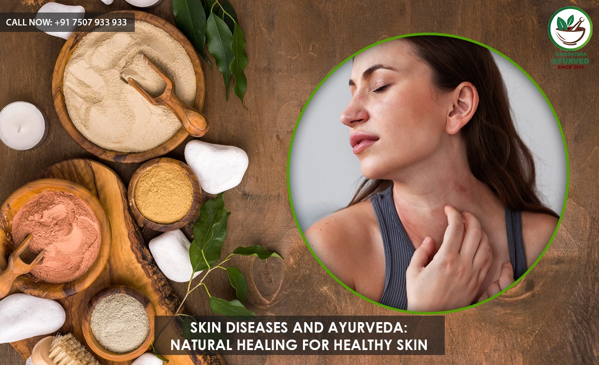 Skin Diseases and Ayurveda: Natural Healing for Healthy Skin