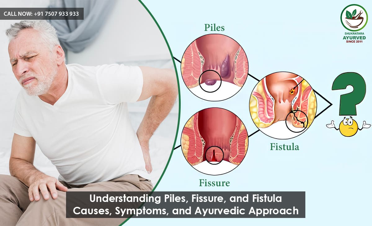 Understanding Piles, Fissure, and Fistula – Causes, Symptoms, and Ayurvedic Approach