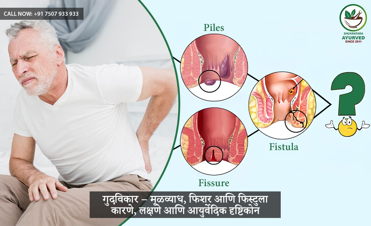 गुदविकार – मूळव्याध, फिशर आणि फिस्टुला कारणे, लक्षणे आणि आयुर्वेदिक दृष्टिकोन