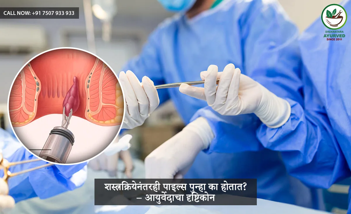शस्त्रक्रियेनंतरही पाइल्स पुन्हा का होतात? – आयुर्वेदिक दृष्टिकोन