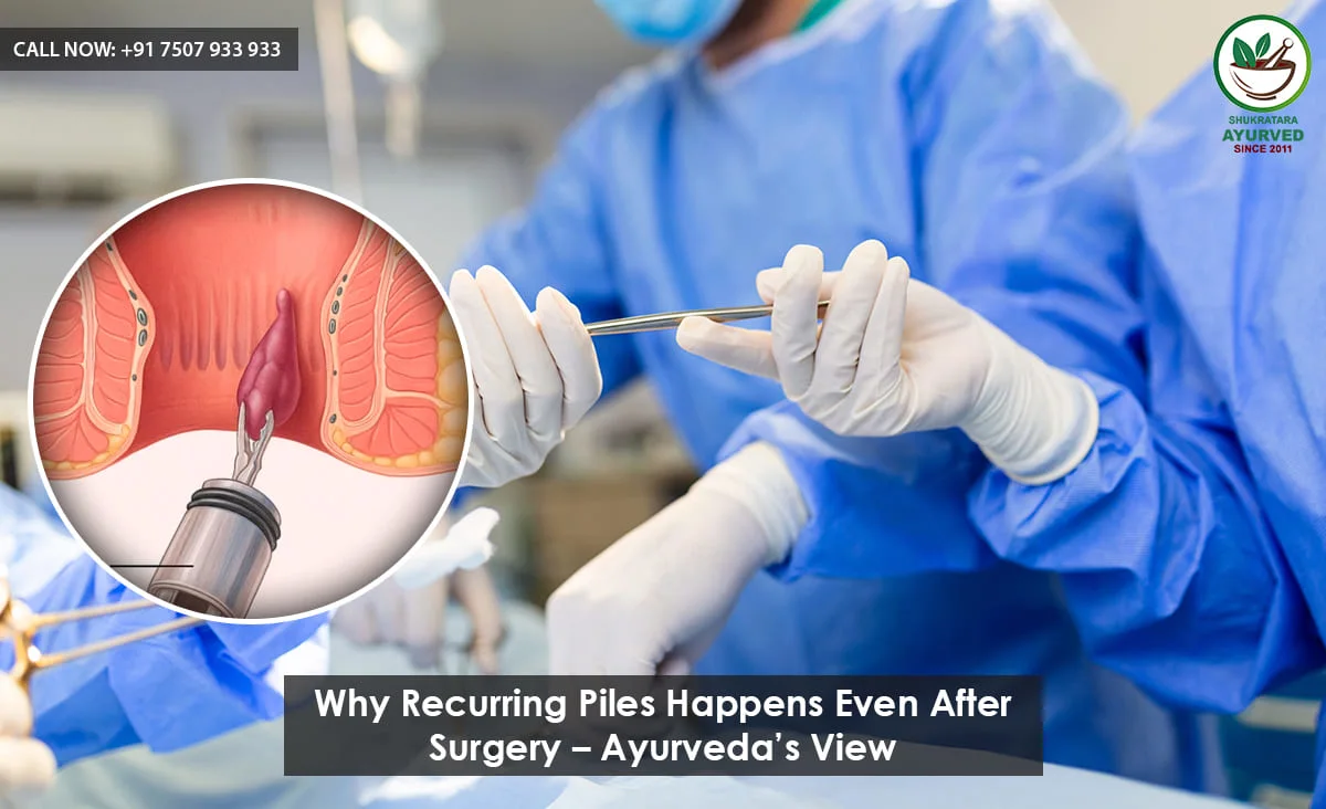 Why Recurring Piles Happens Even After Surgery – Ayurveda’s View